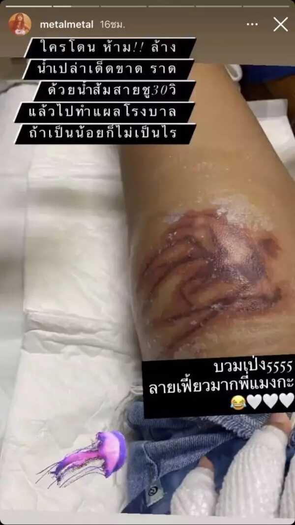 เมทัล สุขขาว