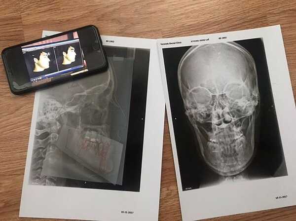 หม่อมเอ็ม