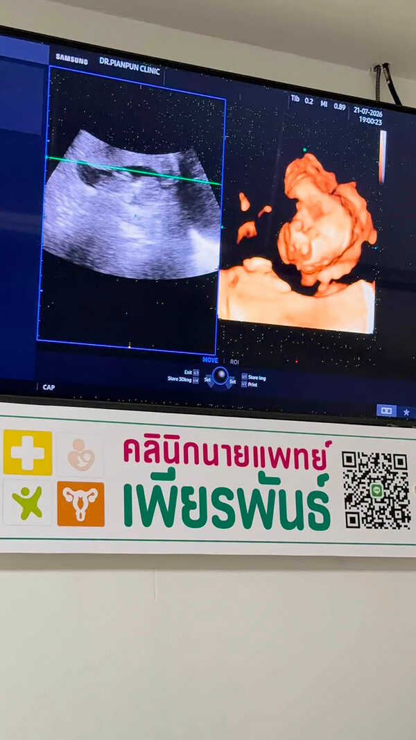 สมปอง