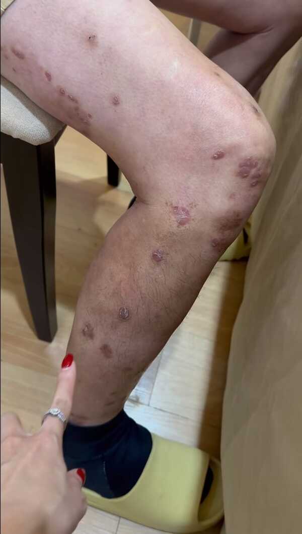  จ๊ะ นงผณี