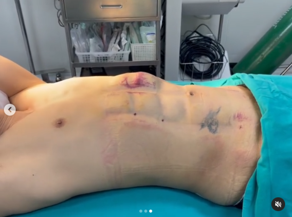 เต้ กันตนา