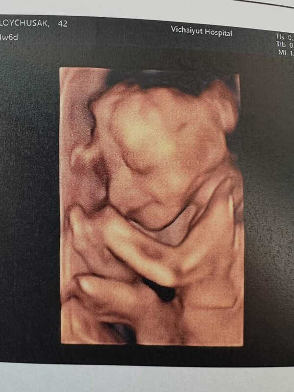  เจมส์ เรืองศักดิ์