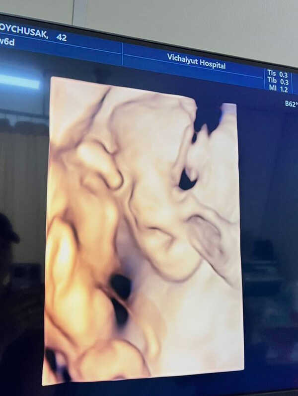  เจมส์ เรืองศักดิ์