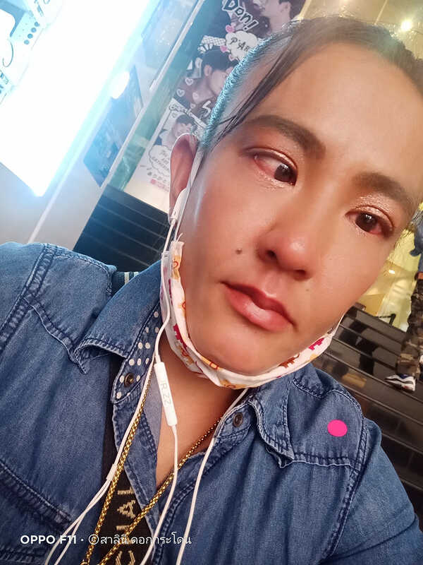 ตาหวาน ดอกกระโดน 