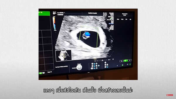 ก้อย รัชวิน ตูน บอดี้สแลม ลูก