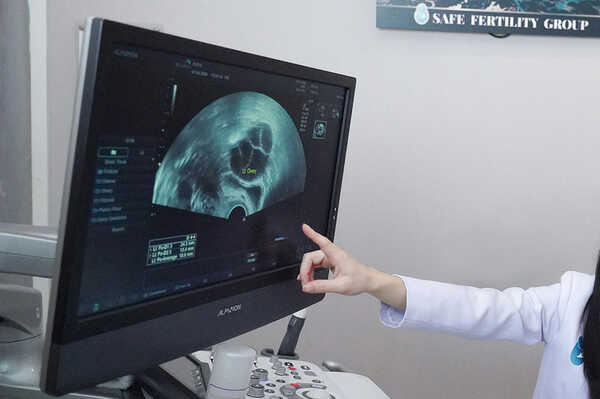 การฝากไข่ (Egg Freezing)
