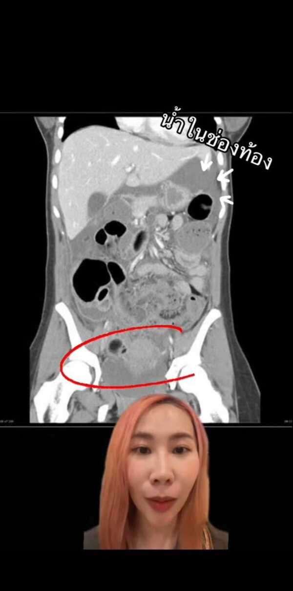 ผีน้าแย้ม ธี่หยด