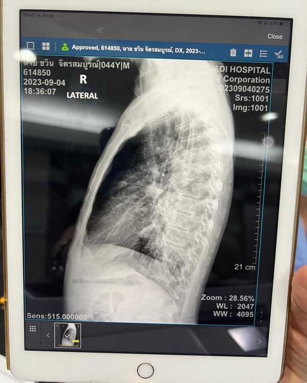 จั๊ก ชวิน