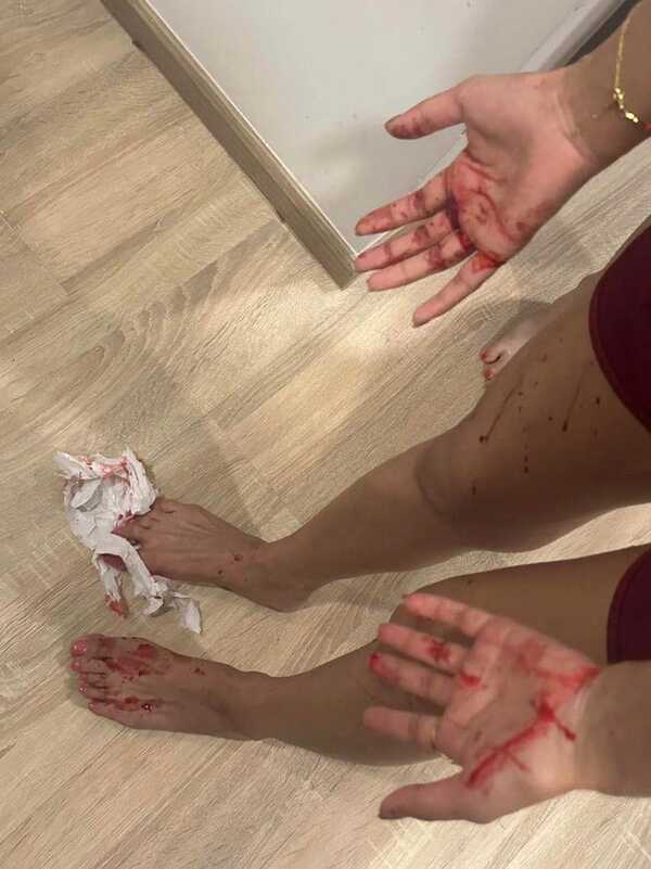 พี่ชายดารา ด. ทำร้ายร่างกายแฟน