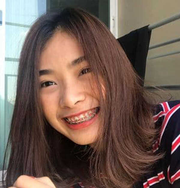 ลูกดาราตลก, บอล เชิญยิ้ม