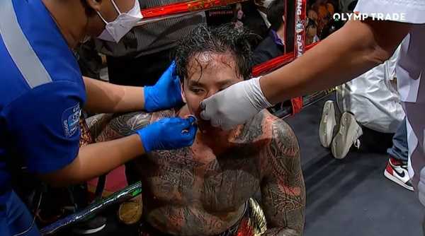 เนท My Mate Nate 