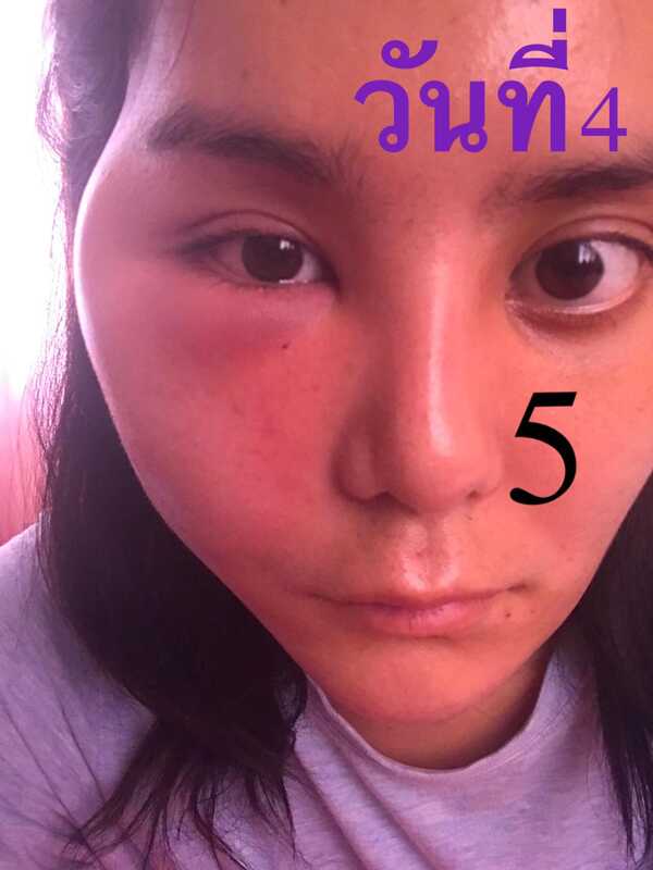 อาร์ม ตรีทิพย์นิภา มิสทรานยูนิเวิร์สไทยแลนด์ 