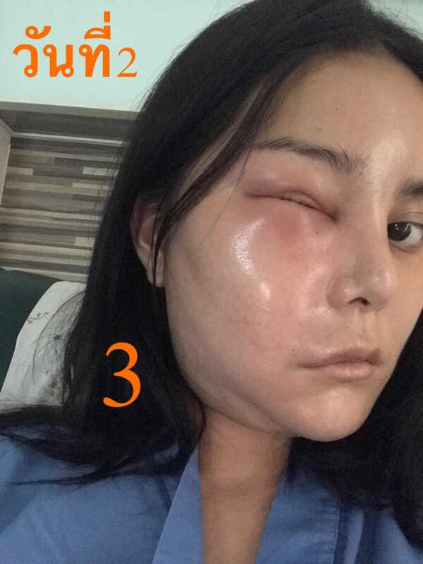 อาร์ม ตรีทิพย์นิภา มิสทรานยูนิเวิร์สไทยแลนด์ 