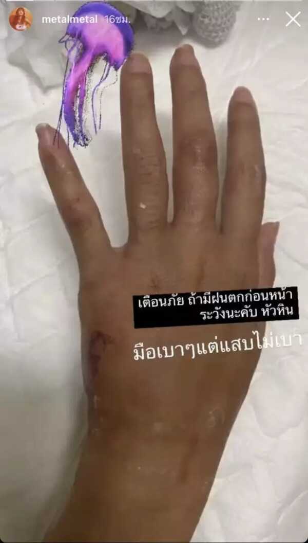 เมทัล สุขขาว