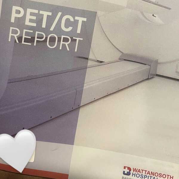  ออน พัชรวรรณ