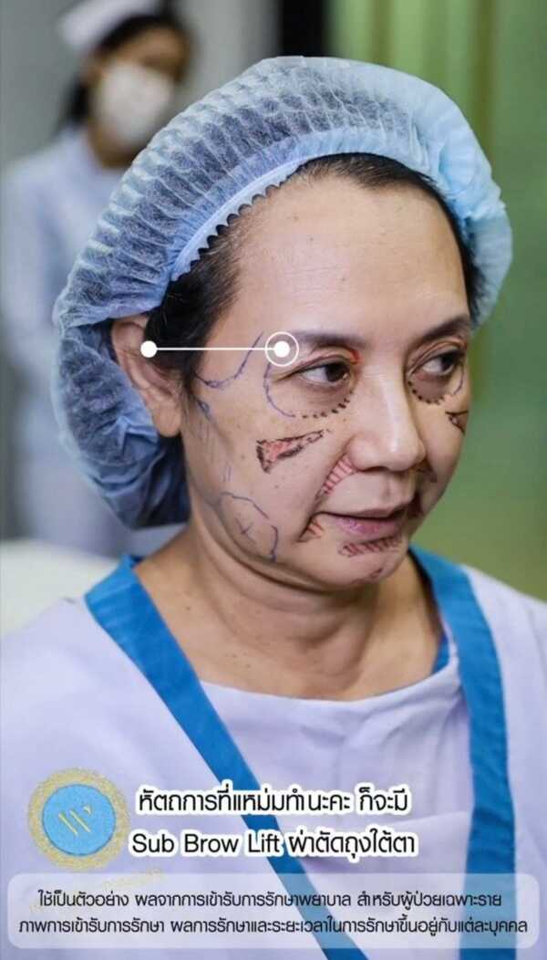 ภาพ แหม่ม จินตหรา ล่าสุด หลังทำศัลยกรรมในวัย 60