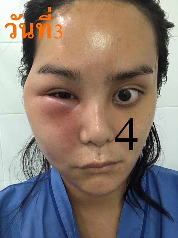 อาร์ม ตรีทิพย์นิภา มิสทรานยูนิเวิร์สไทยแลนด์ 