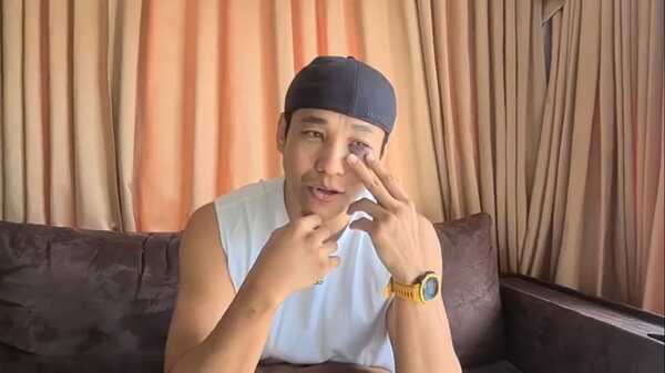  เอ็กซ์ ธิตินันท์ 10 Fight 10