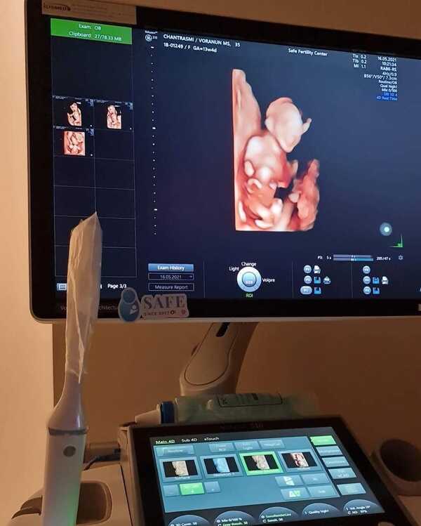 จุ้มจิ้ม วรนันท์ ภัทร