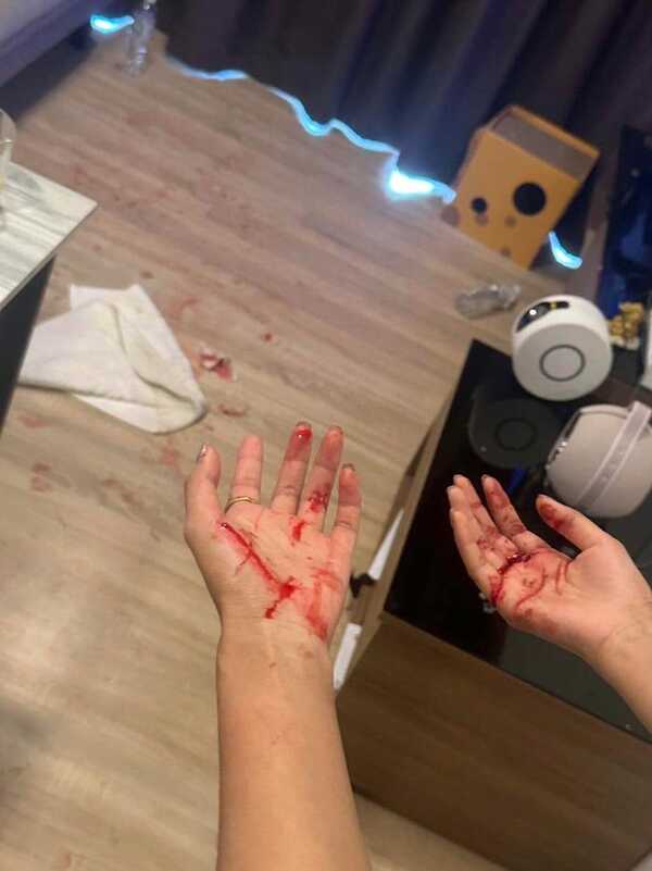 พี่ชายดารา ด. ทำร้ายร่างกายแฟน