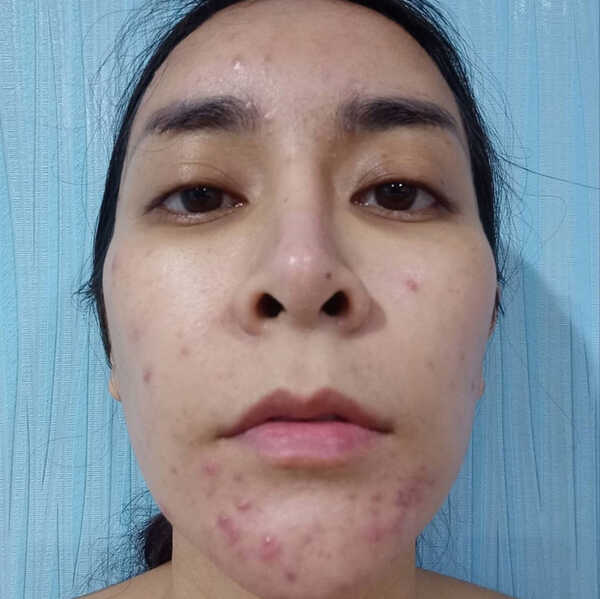 ใหม่ สุคนธวา
