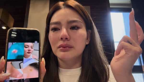 ดิว อริสรา