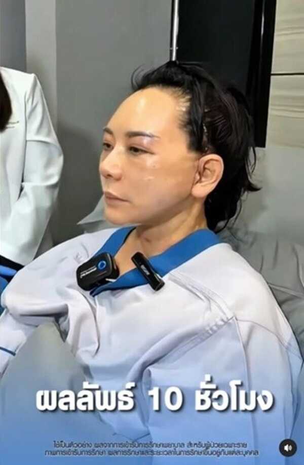 ภาพ แหม่ม จินตหรา ล่าสุด หลังทำศัลยกรรมในวัย 60