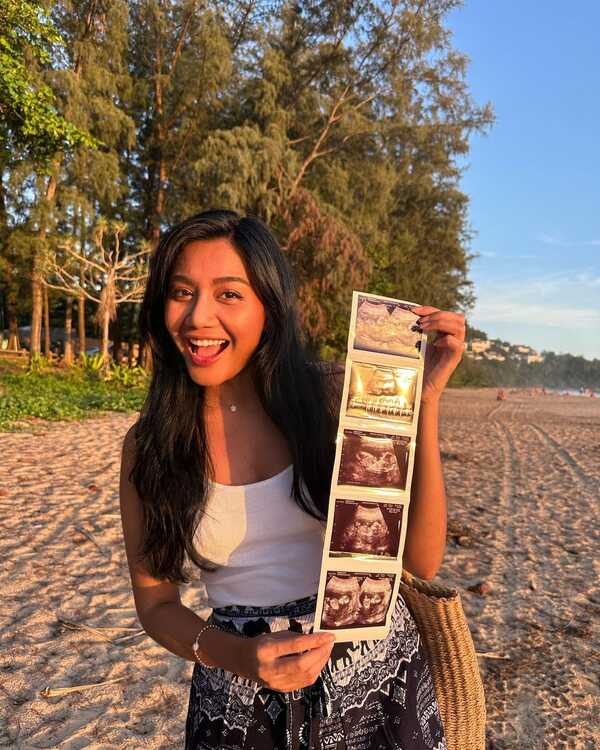 เกศ จิณภัค น้องสาว แก้ม เดอะสตาร์ 